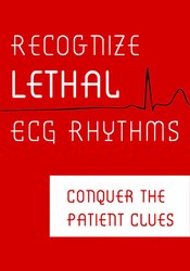 Recognize Lethal ECG Rhythms