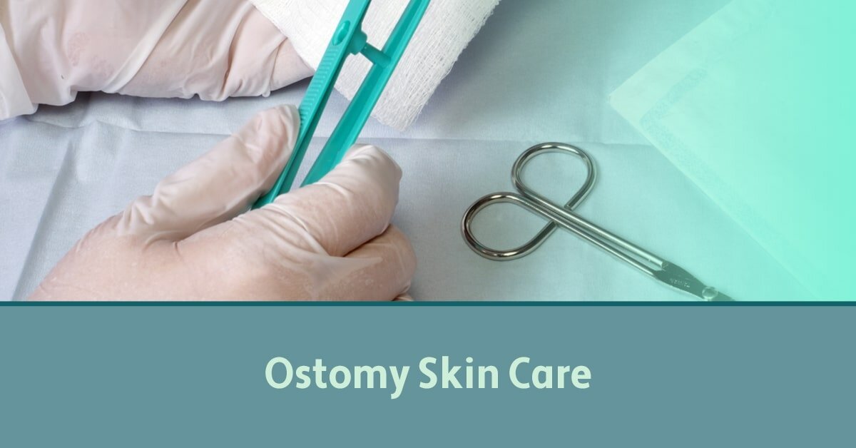 Ostomy Management And Skin Care