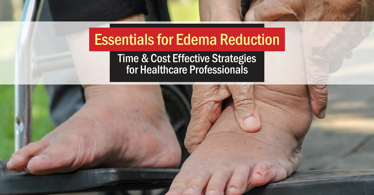 Essentials for Edema ReductionTime & Cost Effective Strategies for
